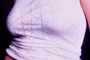 Angelina Jolie's breasts
