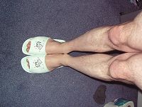 And the winner of this year's knoblly knees competition is...