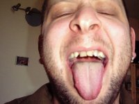 My teeth are terrible. 